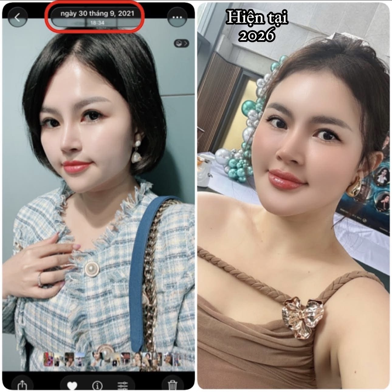 Thanh Tâm ngày 30.9.2021 và hiện tại 2026: gương mặt thon gọn, săn chắc hơn nhờ nâng cơ không phẫu thuật